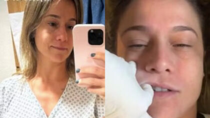 Fernanda Gentil está com paralisia facial e inicia tratamento para conter avanço da doença