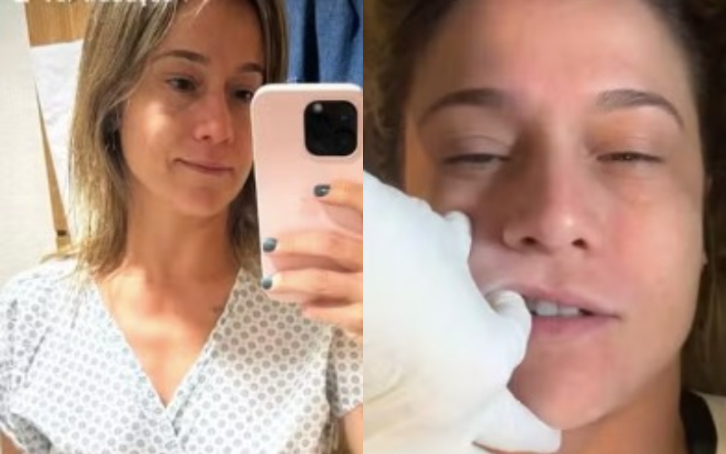 Fernanda Gentil está com paralisia facial e inicia tratamento para conter avanço da doença